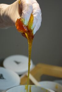 つむじハゲや円形脱毛症に関する最新情報は何ですか？