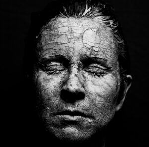つむじ薄毛の頭皮乾燥を改善するための方法は？